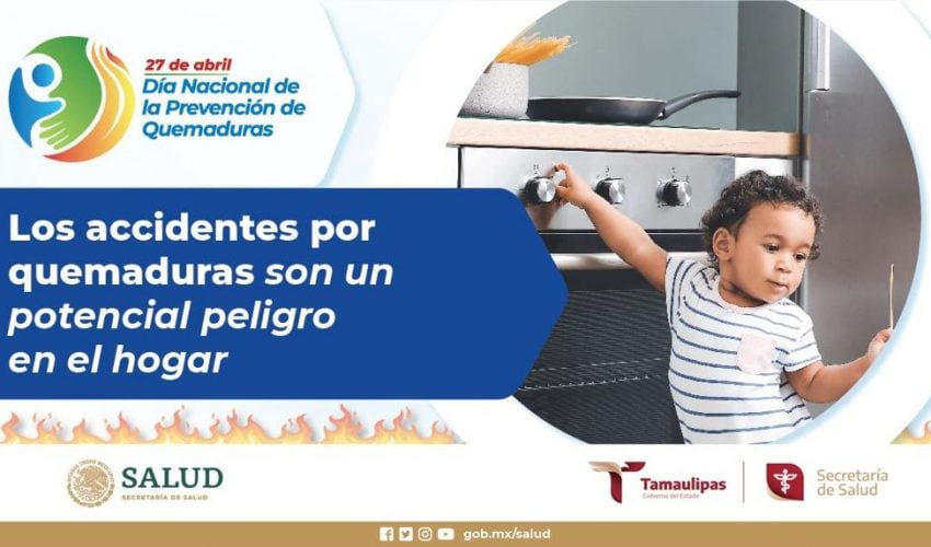 Refuerza Secretaría de Salud de Tamaulipas acciones de prevención de quemaduras